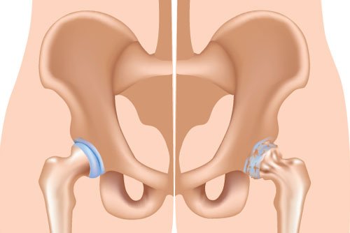 Top Hip Surgeon in Ongole, Prakasam